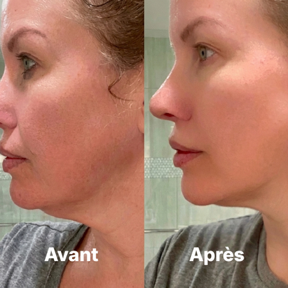 Brosse Lymphatique Elvra