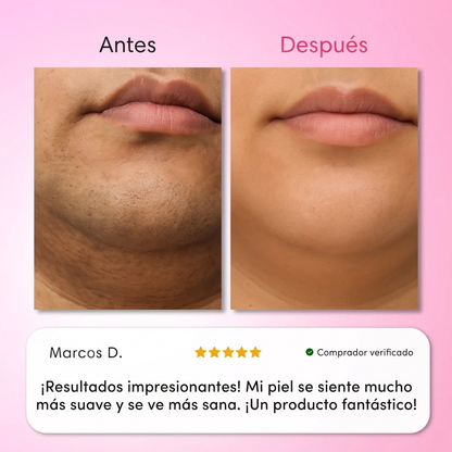 Kit de crema depilatoria