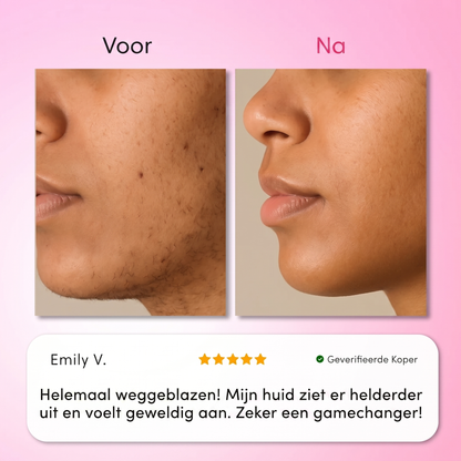 ELVRA Haarentfernungs-Set
